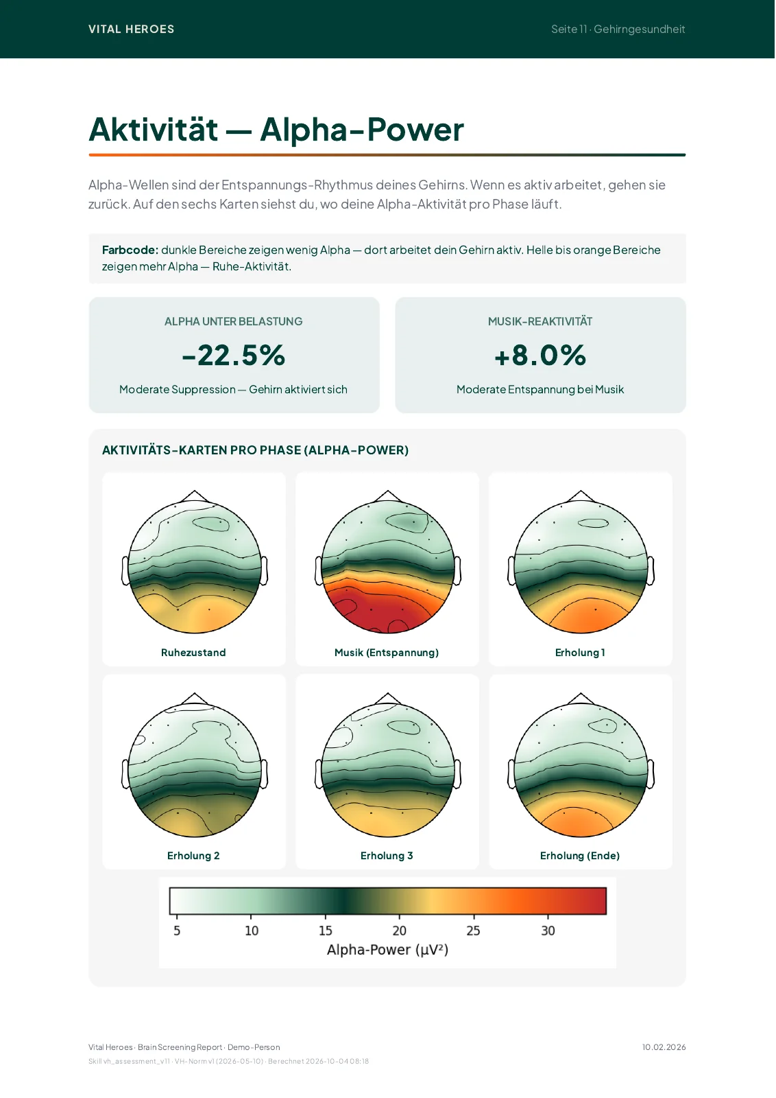 Beispielseite: Brain-Map der Hirnaktivität